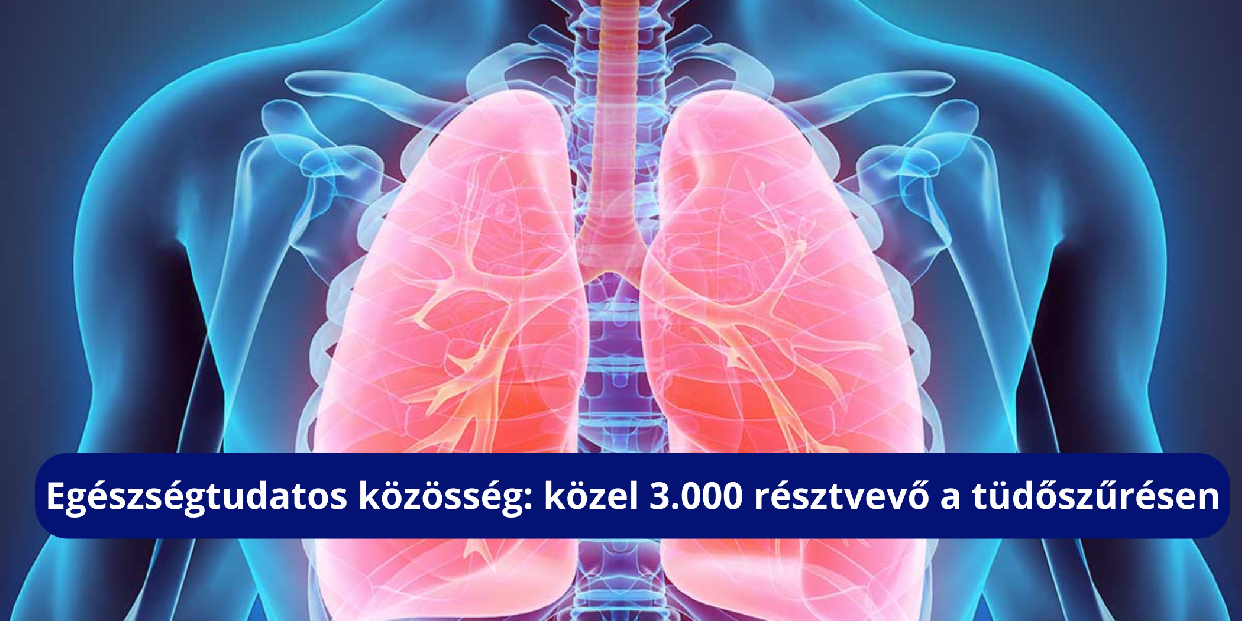 Egészségtudatos közösség: közel 3.000 résztvevő a tüdőszűrésen 