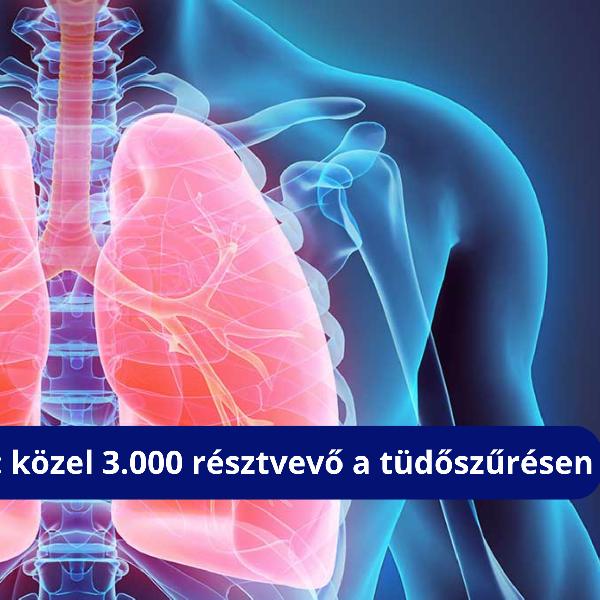 Egészségtudatos közösség: közel 3.000 résztvevő a tüdőszűrésen 